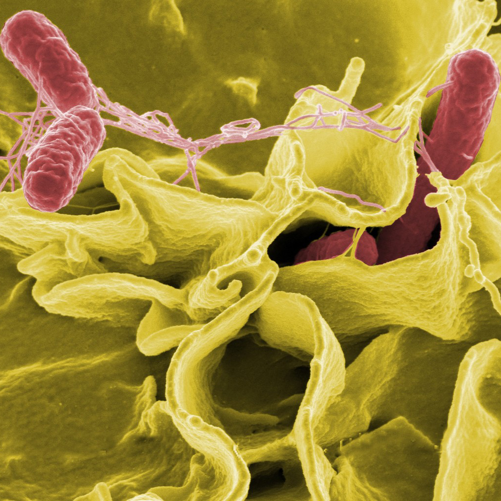 NIH Flickr_Salmonella bacteria