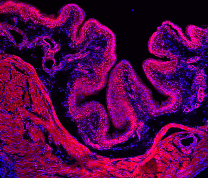 ‘Sixth Sense’ Gene Detects a Full Bladder