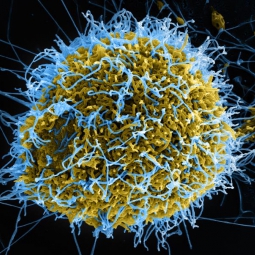 Produced by the National Institute of Allergy and Infectious Diseases (NIAID), this digitally-colorized scanning electron micrograph (SEM) depicts numerous filamentous Ebola virus particles budding from a chronically-infected VERO E6 cell.