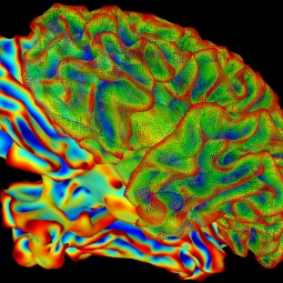 An image of the brain.