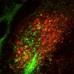 Two different groups of parabrachial neurons, one expressing calcitonin gene-related peptide (green) and the other expressing substance P (red). Source: Arnab Barik, Chesler Laboratory, NCCIH