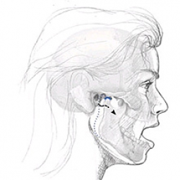 The Temporomandibular Joint, Open