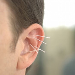 Acupuncture applied to a man's ear.