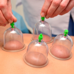 Cupping cups applied to the skin