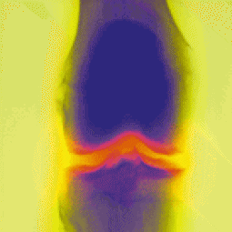X-ray of a joint.