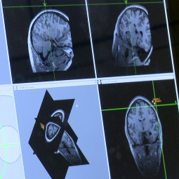 images of a brain scan