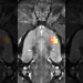 brain scan