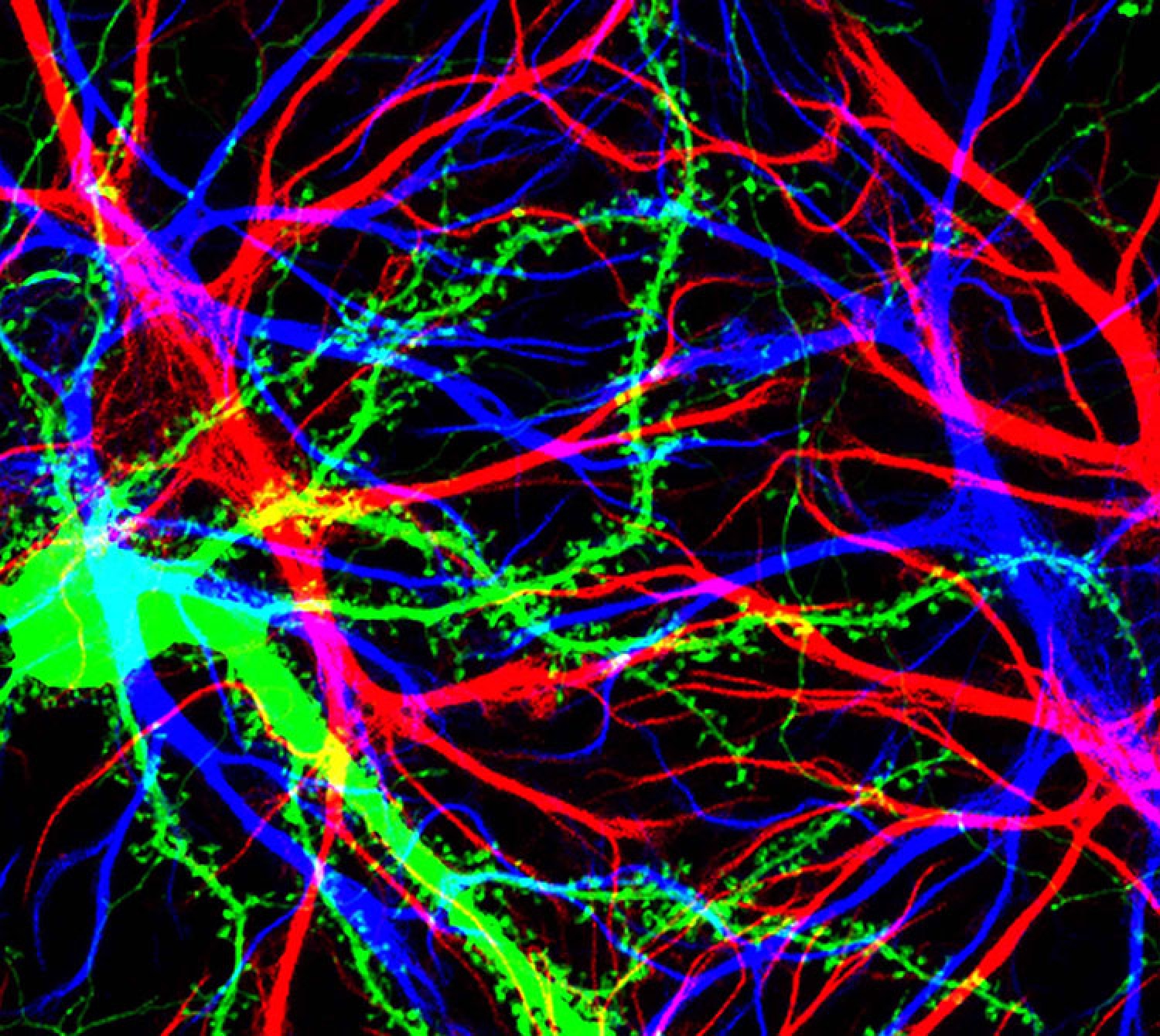 Nerve cells in the brain