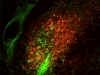 Two different groups of parabrachial neurons, one expressing calcitonin gene-related peptide (green) and the other expressing substance P (red). Source: Arnab Barik, Chesler Laboratory, NCCIH
